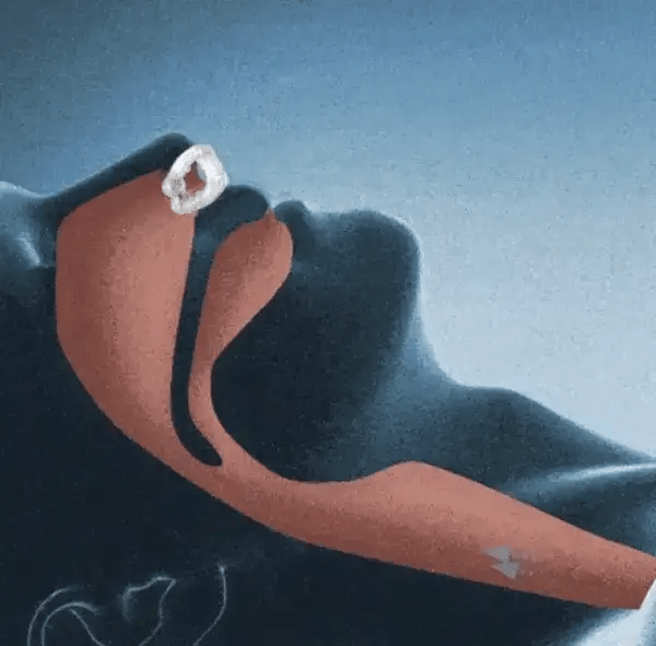 Clemă Anti-Sforăit Magnetică